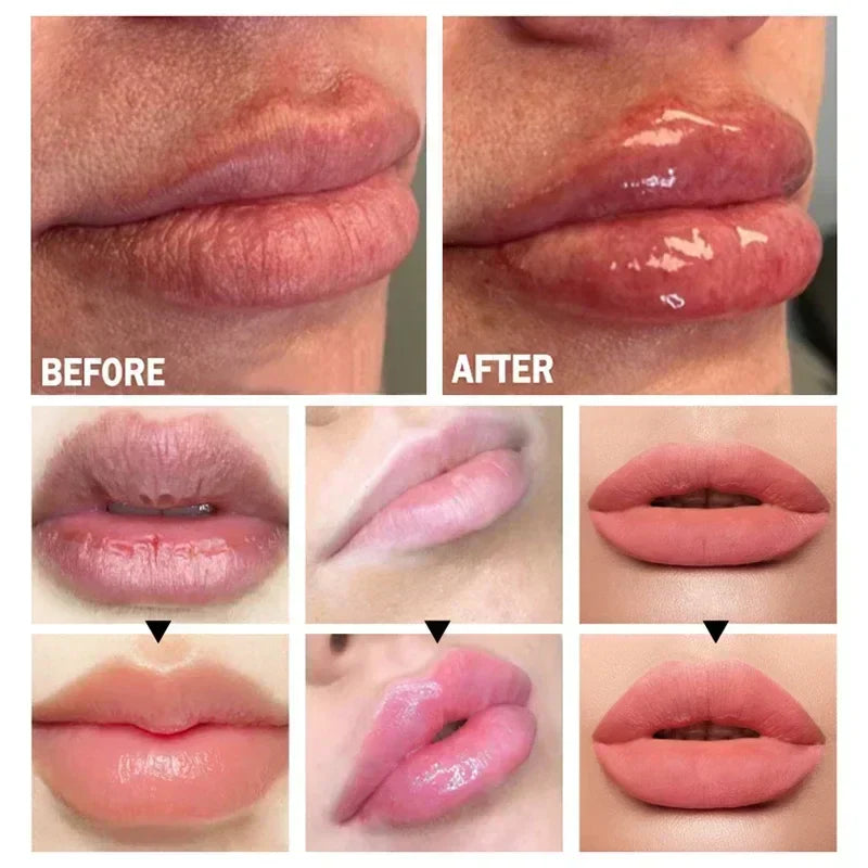 Velara Lip Plumper Serum | Instant Fuller Lips At Home | Lersk