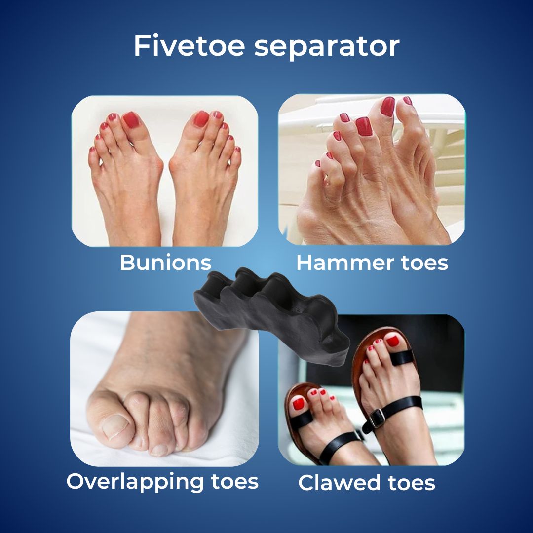 FlexAlign Tåspreder - Tåjustering og Smertelindring ved Hallux Valgus, Overlappende Tæer og Fodkomfort | Lersk