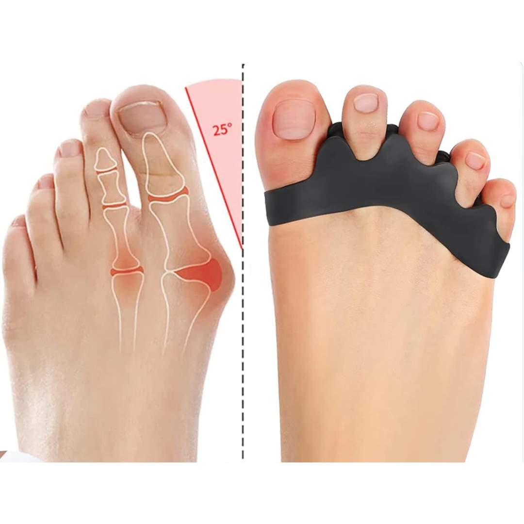 FlexAlign Tåspreder - Tåjustering og Smertelindring ved Hallux Valgus, Overlappende Tæer og Fodkomfort | Lersk