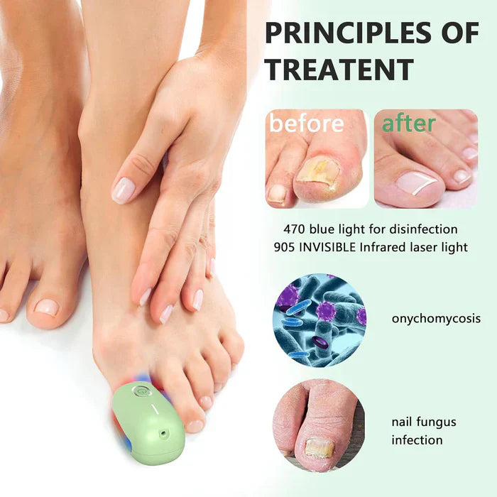Triple-Wavelength Nail Care Laser Therapy Device for Toenail & Fingernail Wellness | Lersk