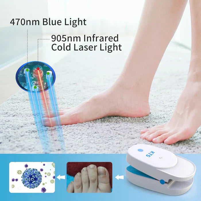 Duales Nagelpflege-Lasergerät mit 905nm- und 470nm-Licht für Nagelgesundheit | Lersk