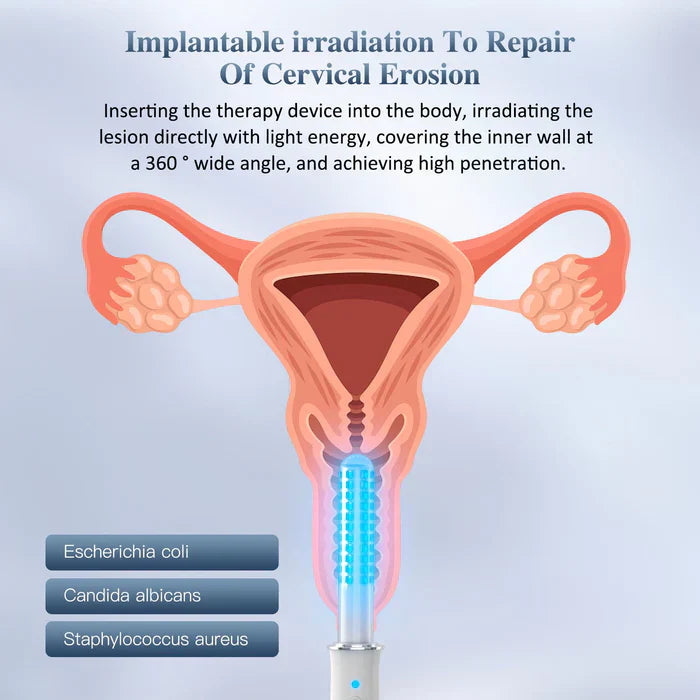 Light Intimate Wellness Wand for Women with Vibration & Smart Timer | Lersk