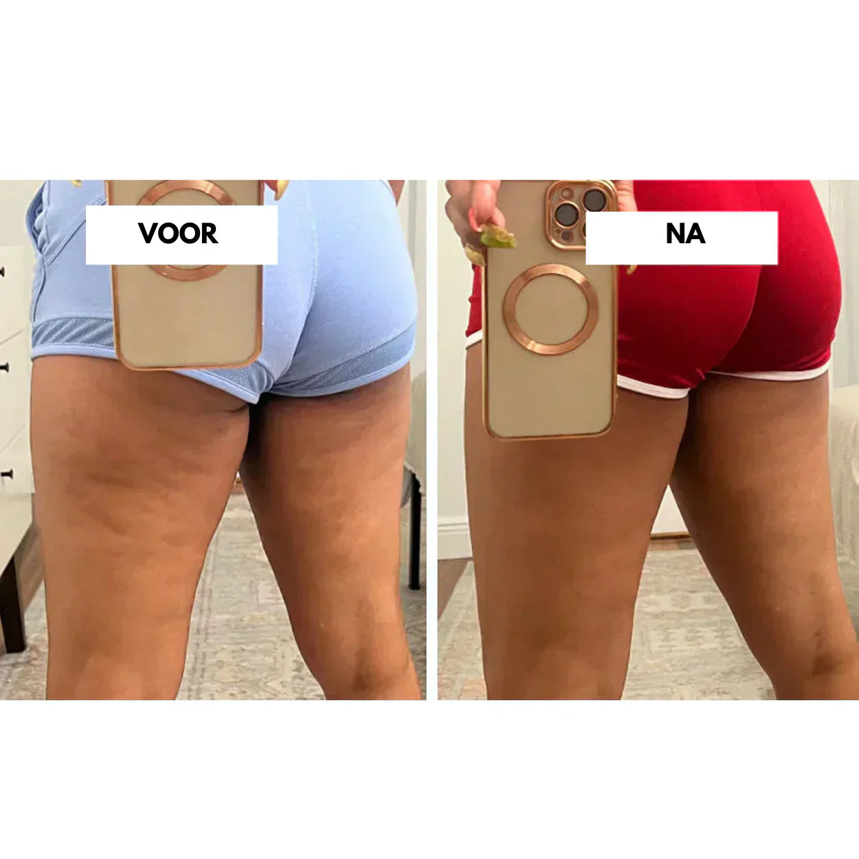 CelluLift vakuový masážní přístroj proti celulitidě pro ženy Pevná pokožka | Lersk