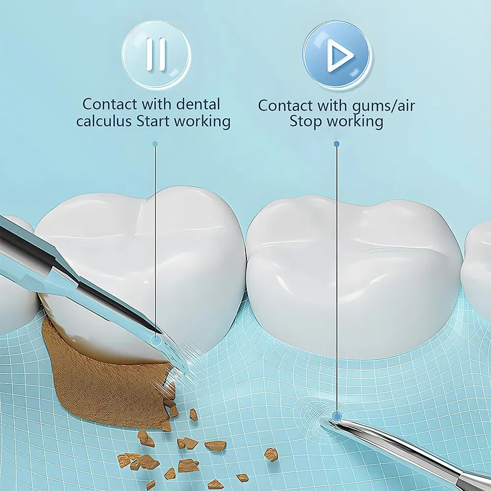 SonicDent 38 kHz Ultrasonic Teeth Cleaner With LED & USB | Lersk