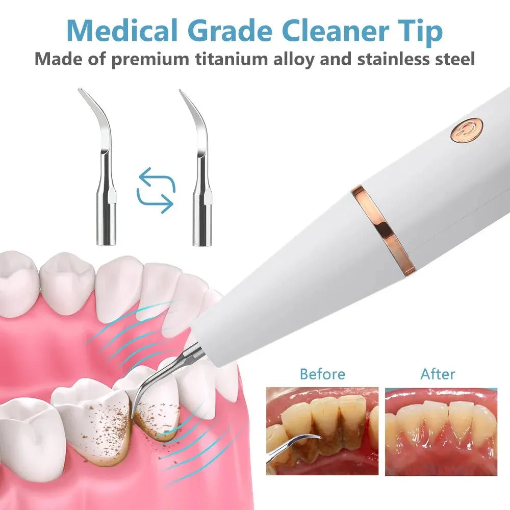 SonicDent 38 kHz Ultrasonic Teeth Cleaner With LED & USB | Lersk