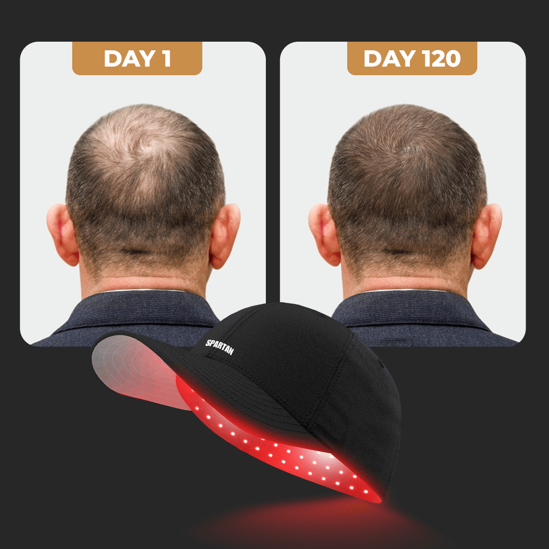 Red LED Light Therapy Cap for Scalp Care & Hair Wellness Routine | Lersk