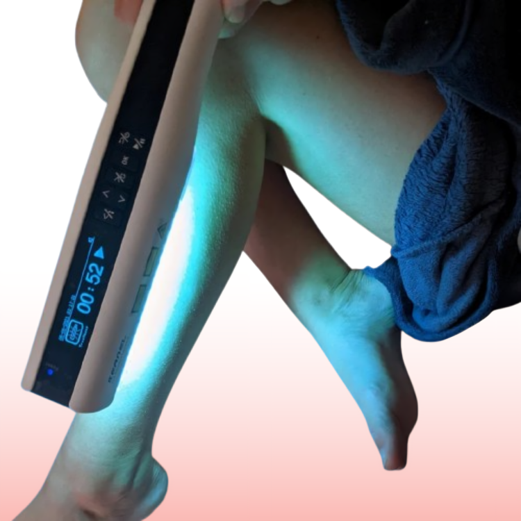 Lumara Pocket UVB-lysterapilampe 311nm til psoriasis og vitiligo | Lersk