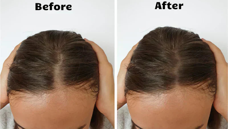 LumaNova Hair Light Therapy System for Fuller Hair | Lersk