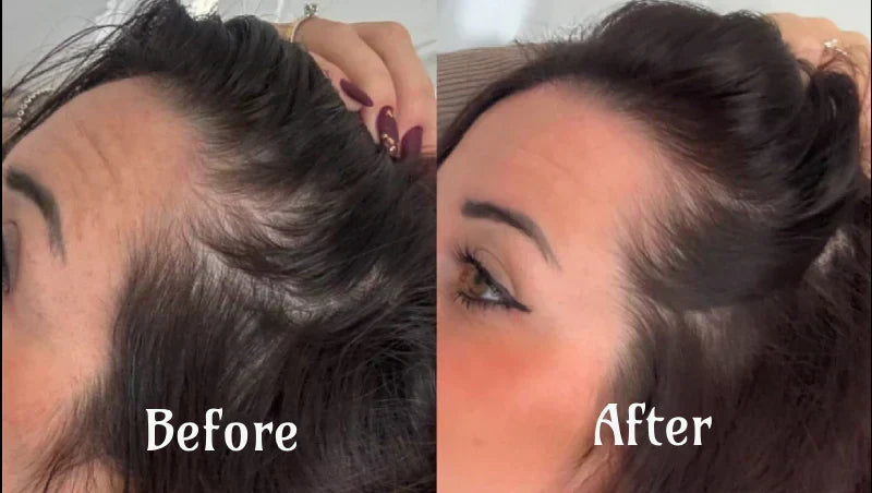 AstraGlow Hair Light Therapy for Thicker, Fuller Hair
