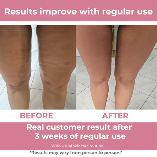 FirmFlex Pro Üçlü Etkili Cilt Sıkılaştırıcı Rulo | Lersk