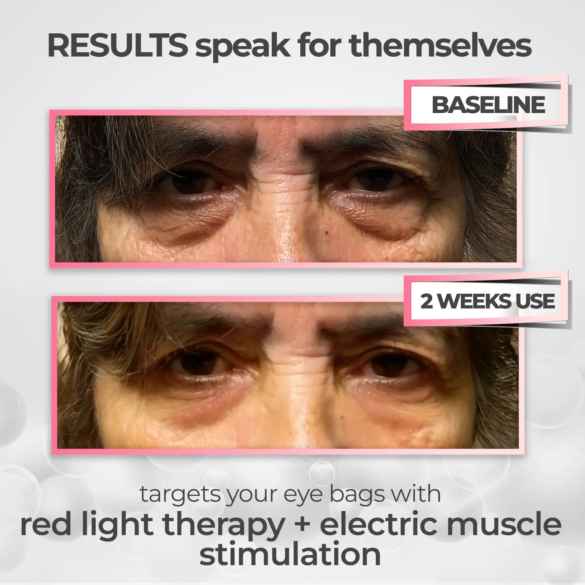 LumaNova Eye Rejuvenator Red Light and Microcurrent Therapy | Lersk