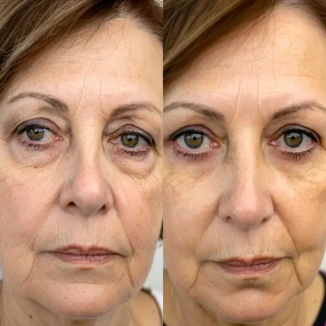 LumaNova Eye Rejuvenator Red Light and Microcurrent Therapy | Lersk