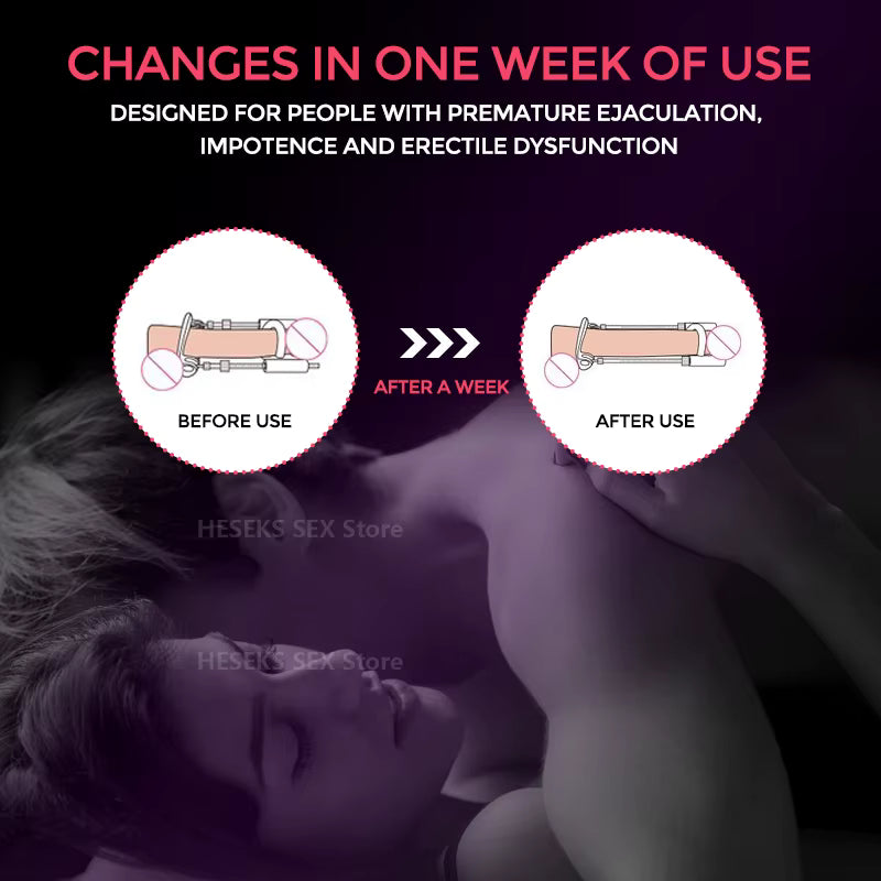 Quellix Male Traction Device for Enhancement and Support