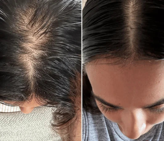 Lumora The Natural Escova Restauradora de Cabelo 3 em 1 | Massajador de Couro Cabeludo | Lersk