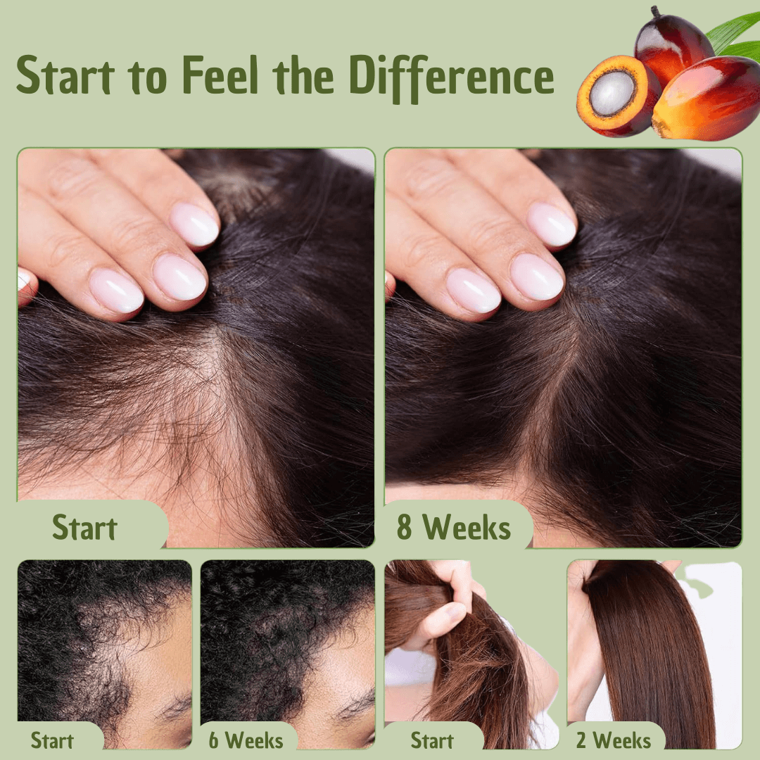 Marava Hair Elixir | Batana Oil | Deep Hydration, Strength and Shine | Lersk