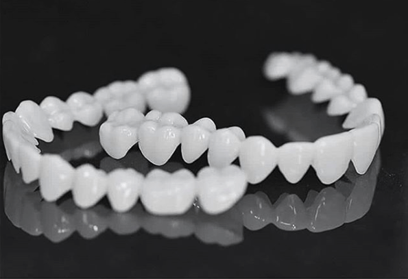 SmileFlex Dental Prosthesis With White Veneers For A Subtle, Lifelike Smile And Natural Look | Lersk