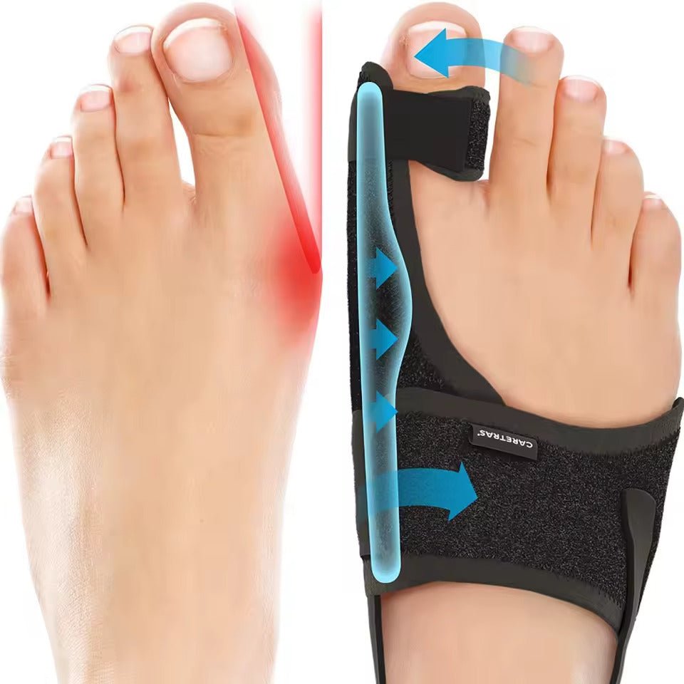Night Splint For Hallux Valgus With Ergonomic Design And Adjustable Comfort For Sleep | Lersk