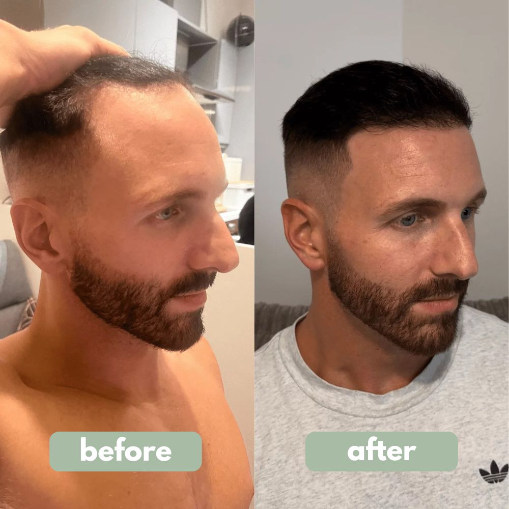 Roll-On Rivitalizzante per Capelli Pro-Crescita | Lersk