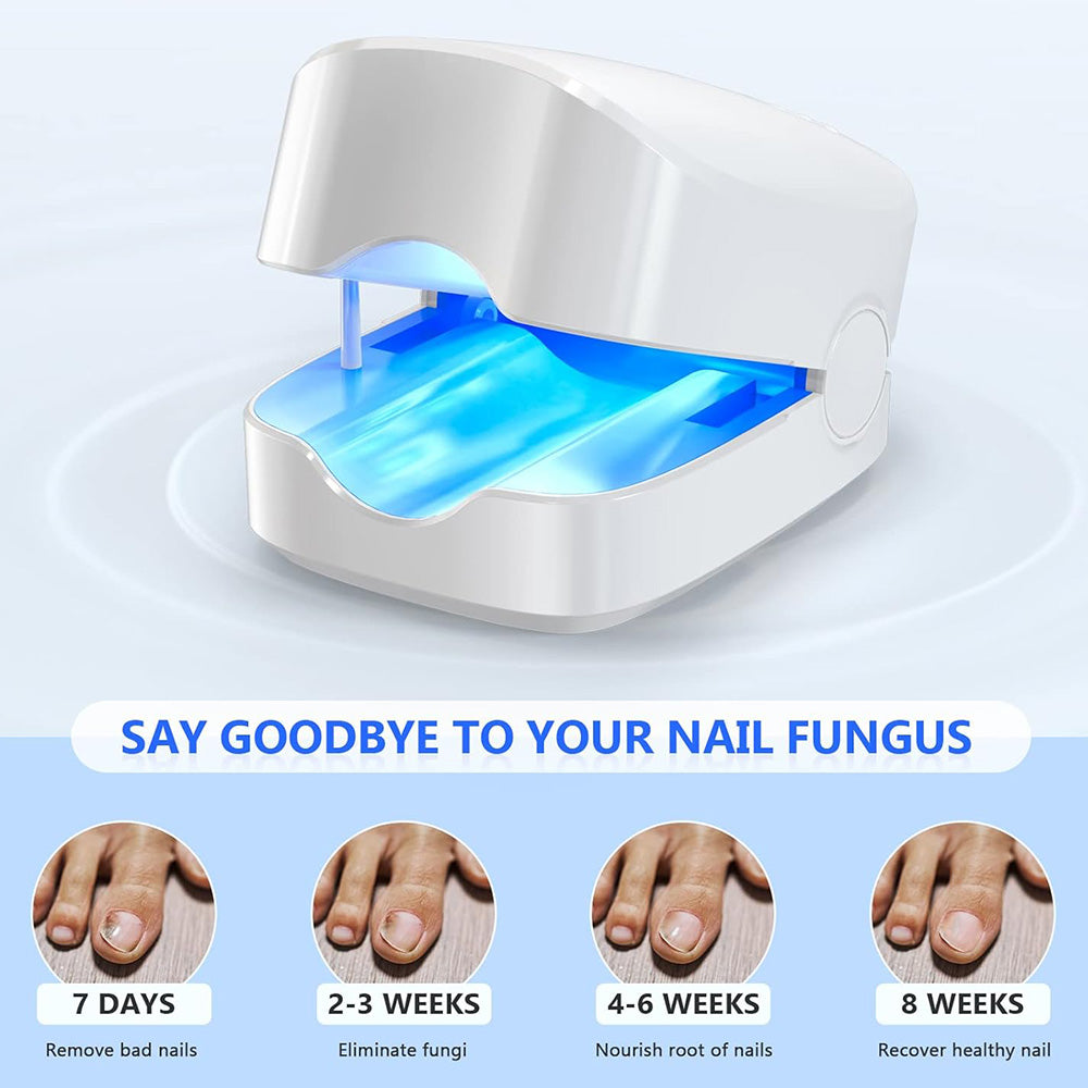 Appareil de traitement au laser NexaLume à domicile pour mycose des ongles de pieds | Lersk