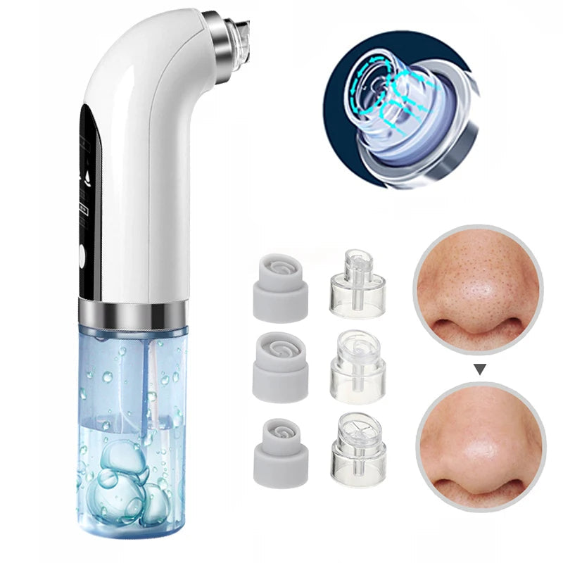 Dermora Nose Blackhead Remover Vacuum With Gentle Suction | Lersk