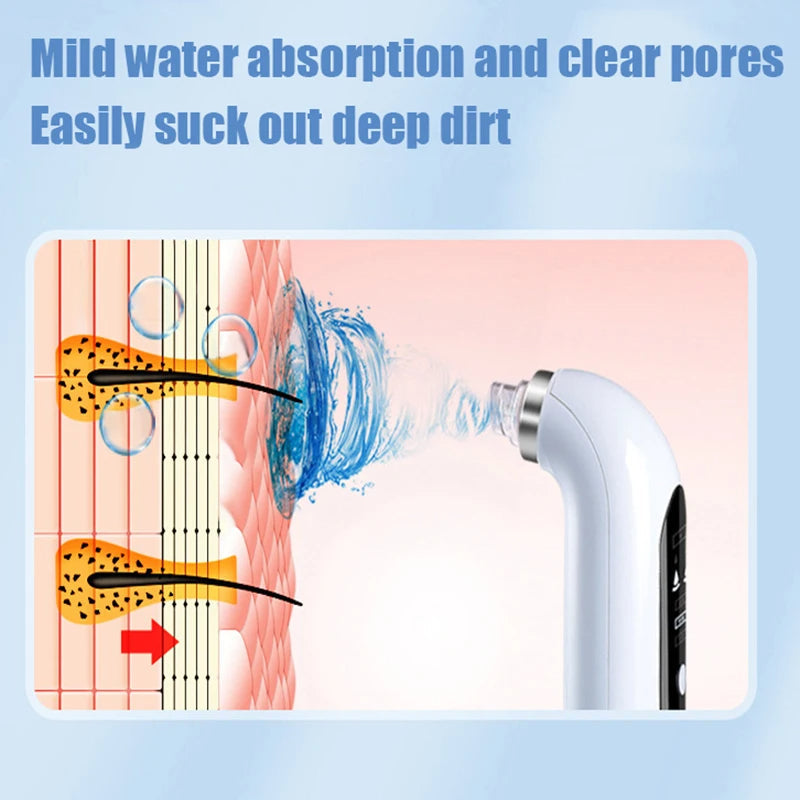 Dermora Nose Blackhead Remover Vacuum With Gentle Suction | Lersk