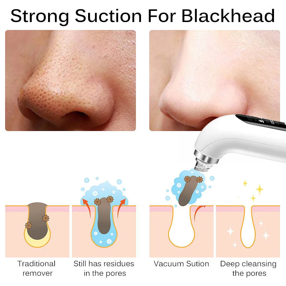 Dermora Nose Blackhead Remover Vacuum With Gentle Suction | Lersk