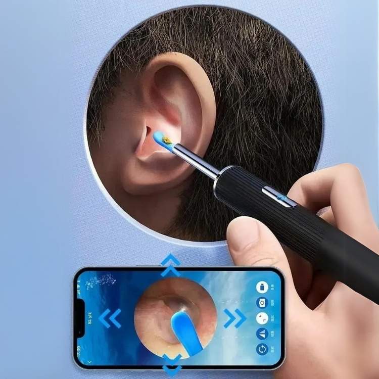 Auracle Pro domácí sada na ušní maz s HD kamerou a LED diodami | Lersk