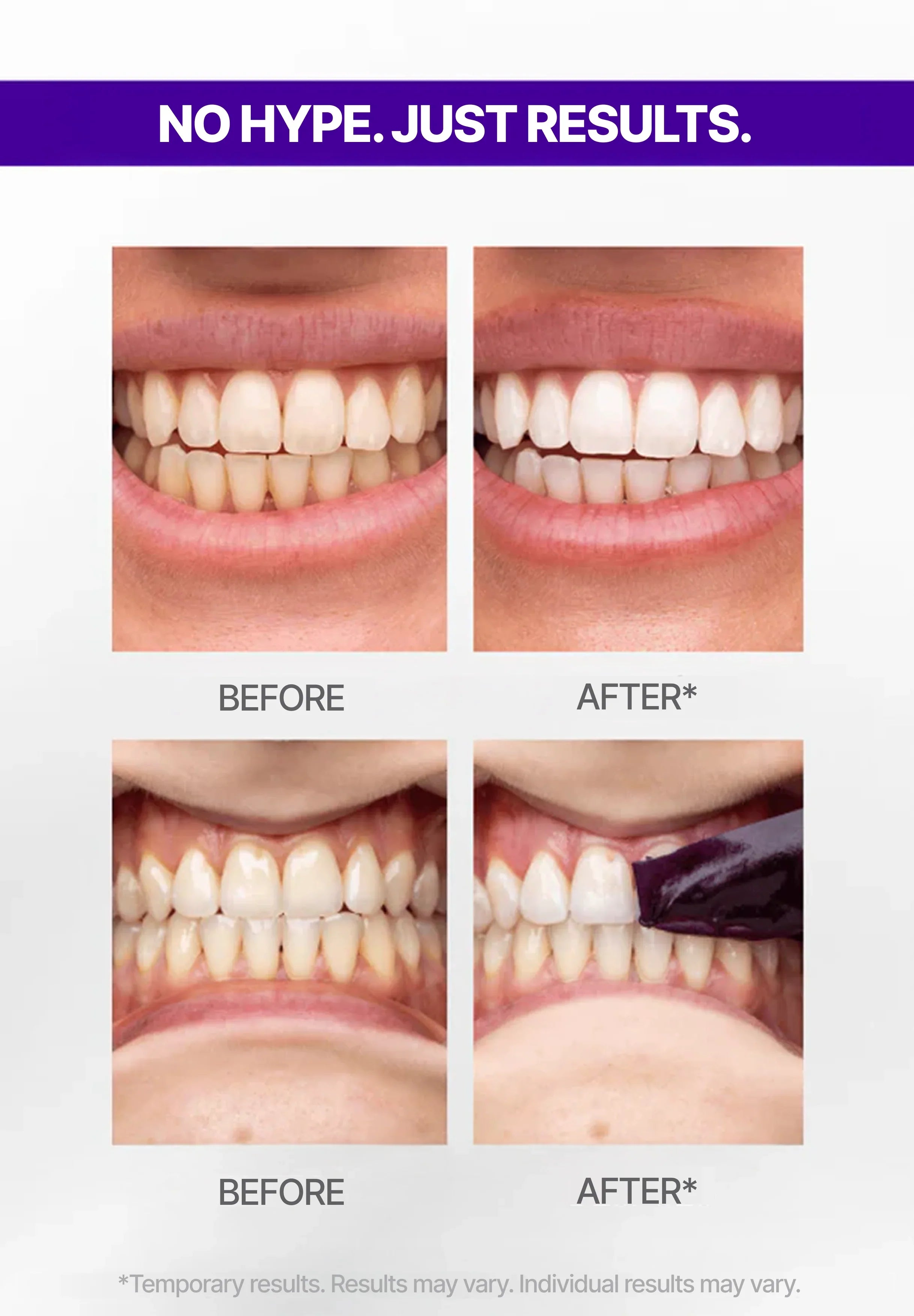 V34 Purple Whitening Strips – Instant Color-Correcting Teeth Whitening with PAP+ Technology | Lersk