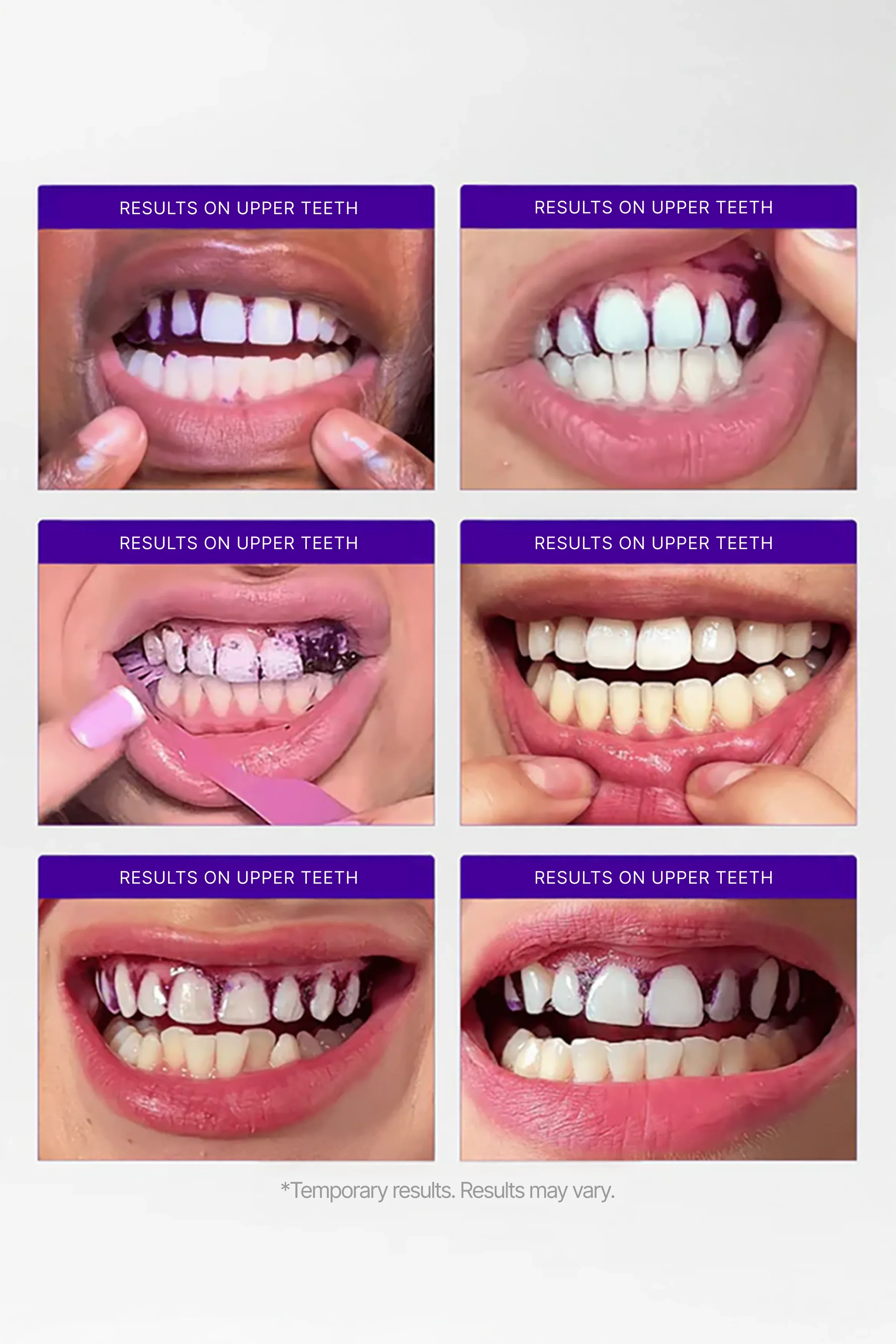 V34 Purple Whitening Strips – Instant Color-Correcting Teeth Whitening with PAP+ Technology | Lersk