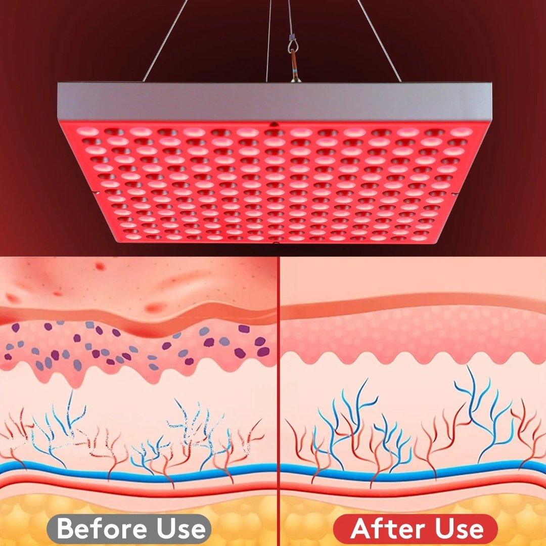 Lampada per terapia a luce rossa SolaraLift per recupero del sonno, sollievo dal dolore e salute della pelle | Lersk