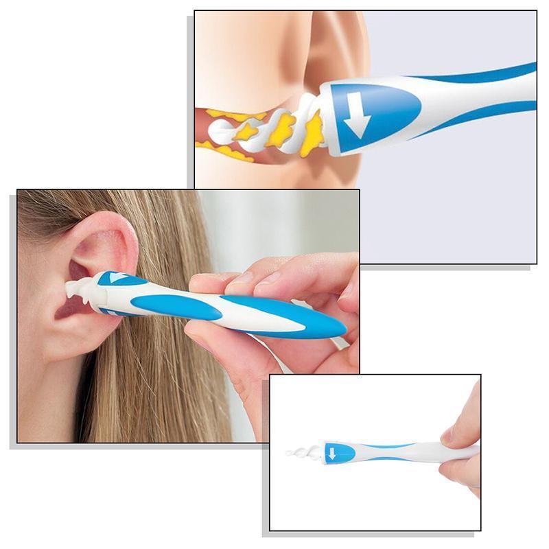 Smart Earpick Spiral Ear Wax Remover Cleaner With 16 Tips For Comprehensive Ear Cleaning | Lersk