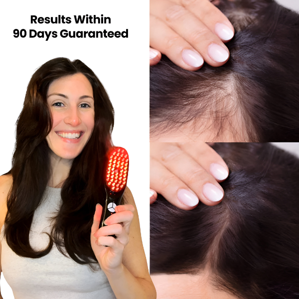LumaRevive | 4-in-1 Red Light Hair and Scalp Therapy Brush