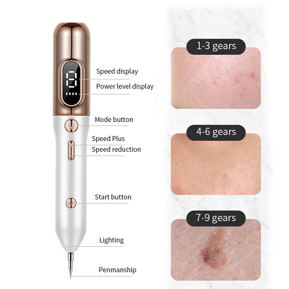 LuminaDerm Plasma Pen for Skin Spots Birthmarks and Warts Safe and Gentle | Lersk