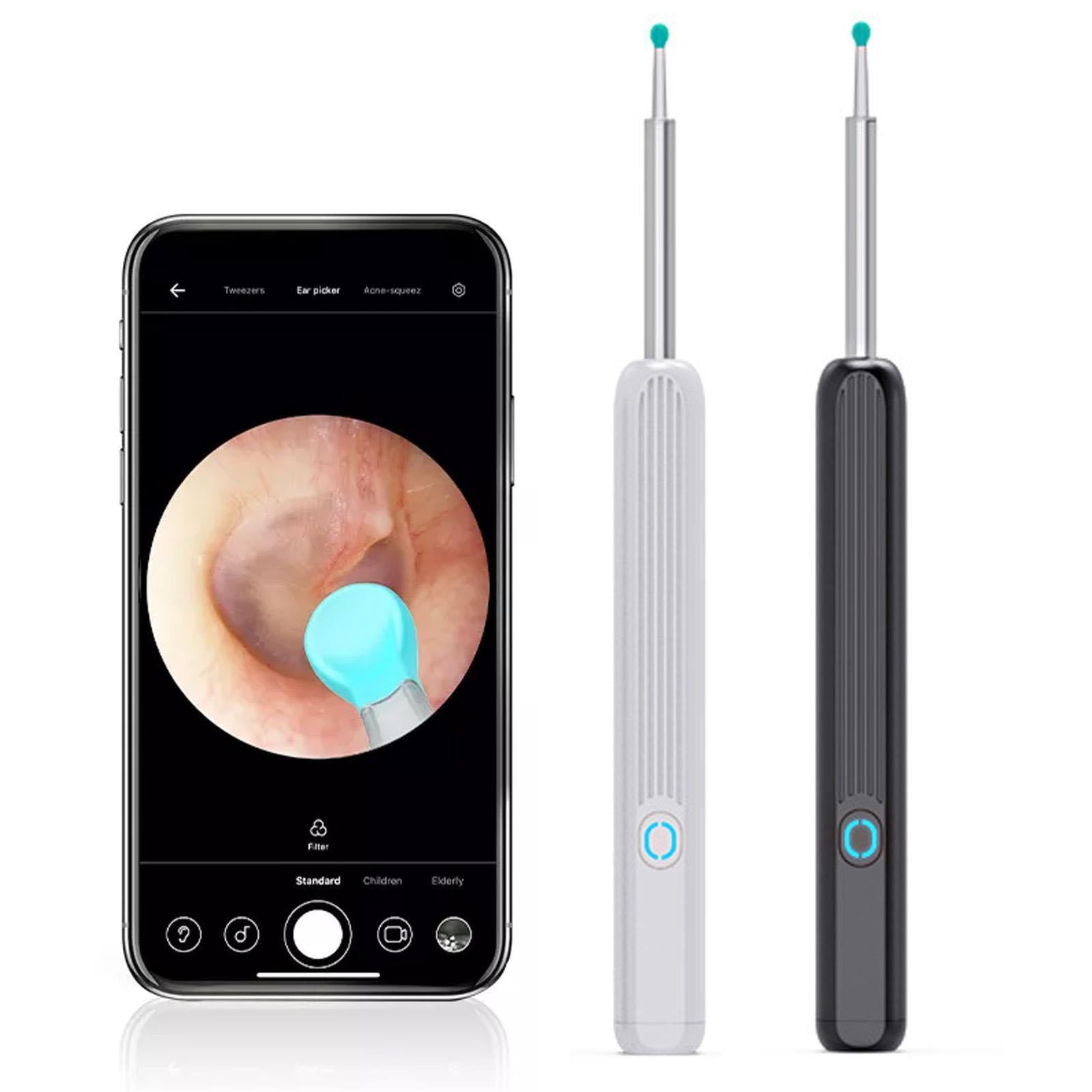 Auravue Earwax Inspection Camera | Lersk