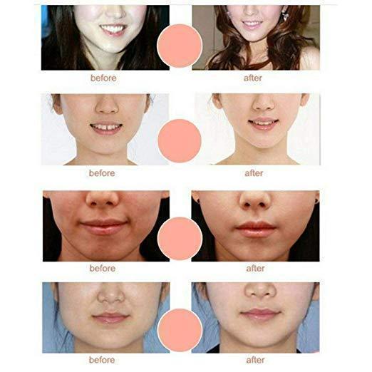 V Line Chin Up Face Lift Mask | Lersk